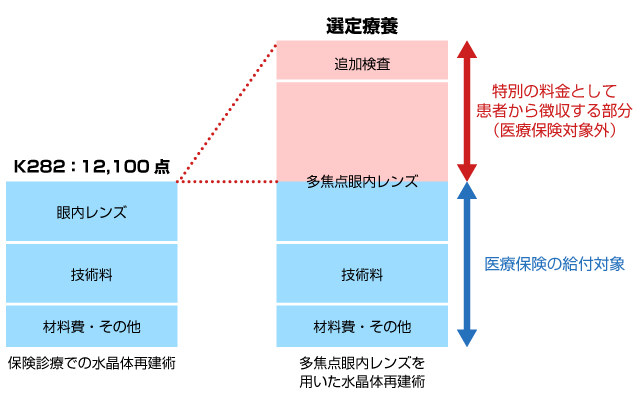 選定療養